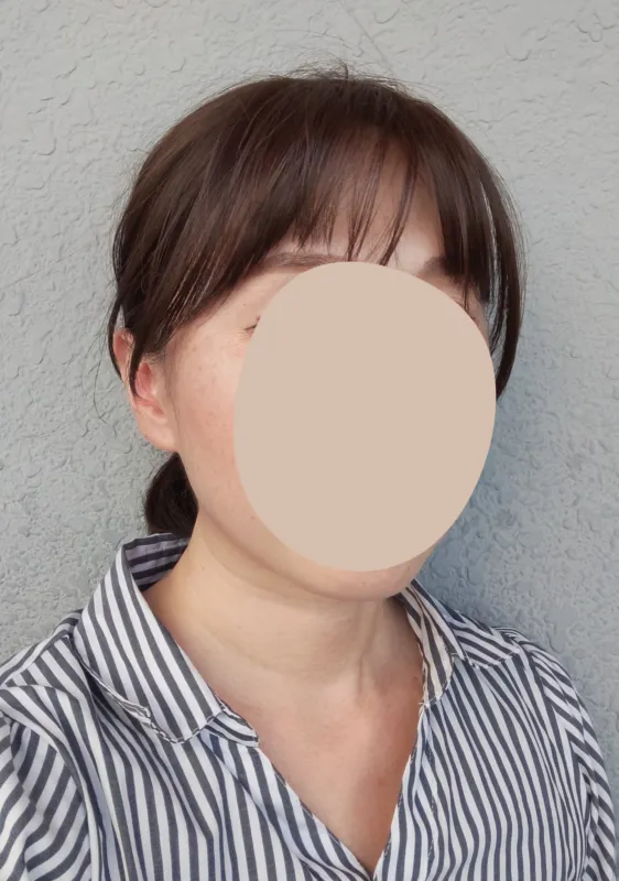 にゃんたのヘアピース着用画像(正面)