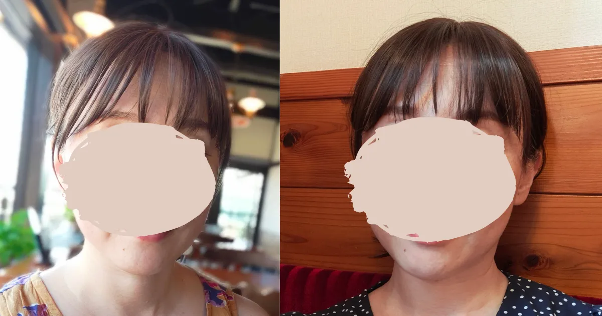 ピンクエイジはバレるのか？前髪つき部分ウィッグ・ヘアピースの本人 
