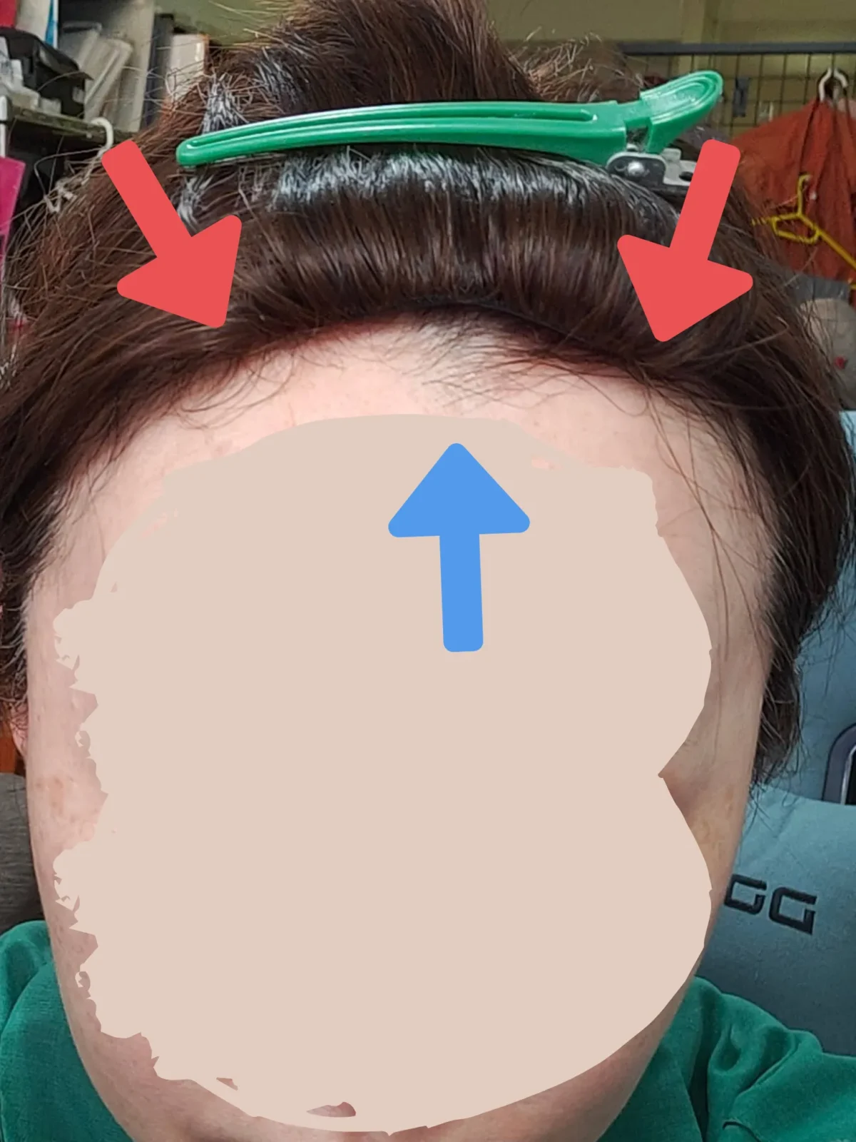 部分ウィッグ/ヘアピースの正しい「付け方・馴染ませ方」完全ガイド 
