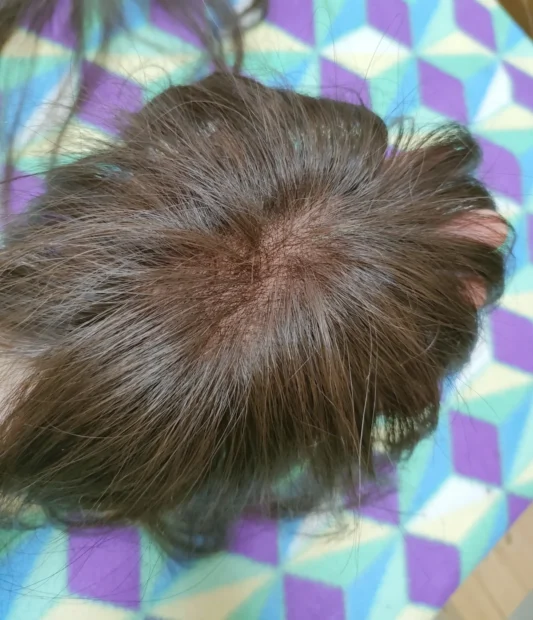 ブライトララの人毛100％ 総手植え ナチュレトップヘアピースを手のひらに載せたときの外観