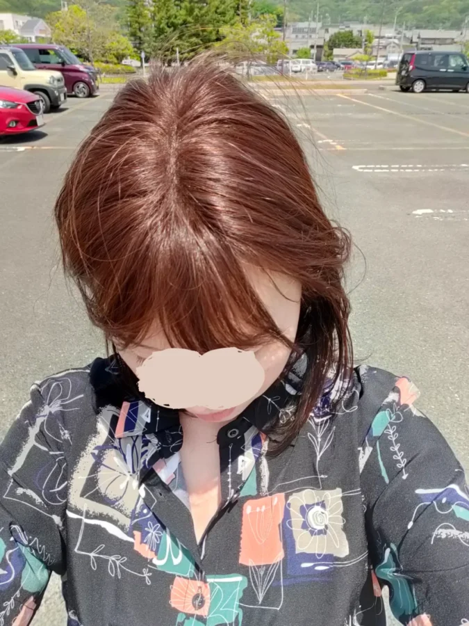 人毛100％総手植えナチュレトップヘアピース/前方頭頂部から