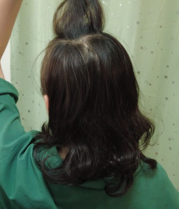 私のつむじまわり：背面から