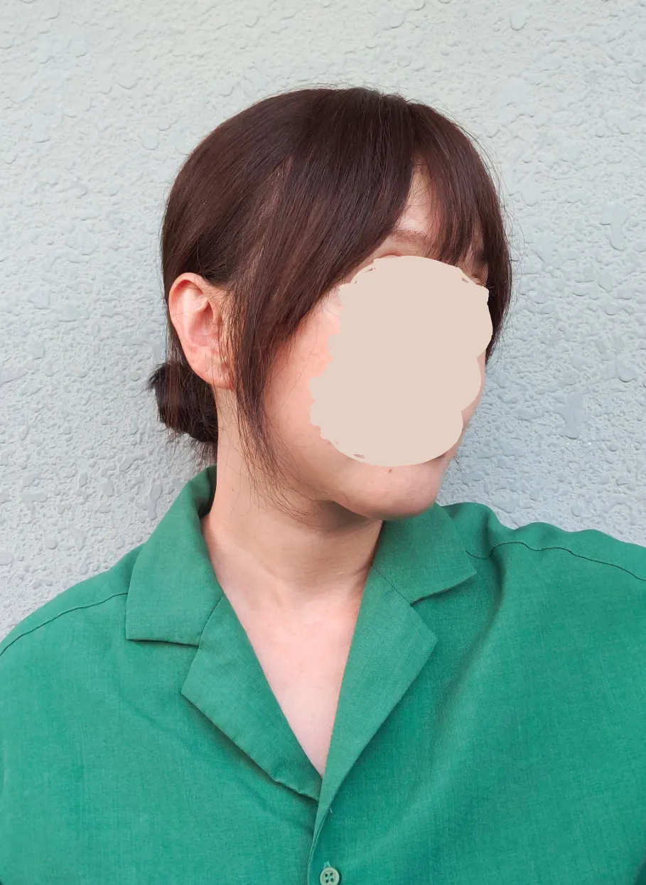 私元気ヘアピースカット後画像右斜め前から