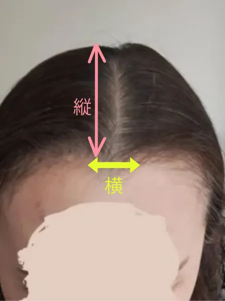 ヘアピースの縦×横はここを実測