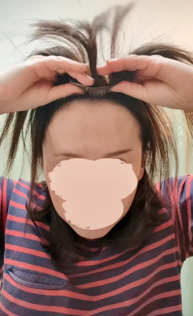 ヘアピース生え際クリップを留めている様子