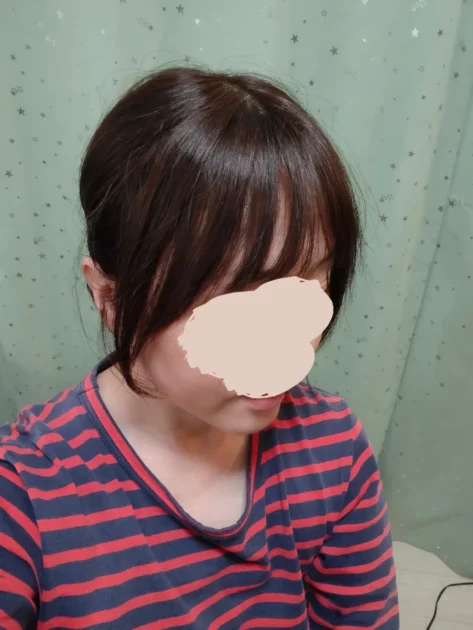 私元気ヘアピース装着完成図